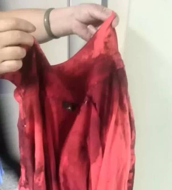 林女士被血浸湿的衣服